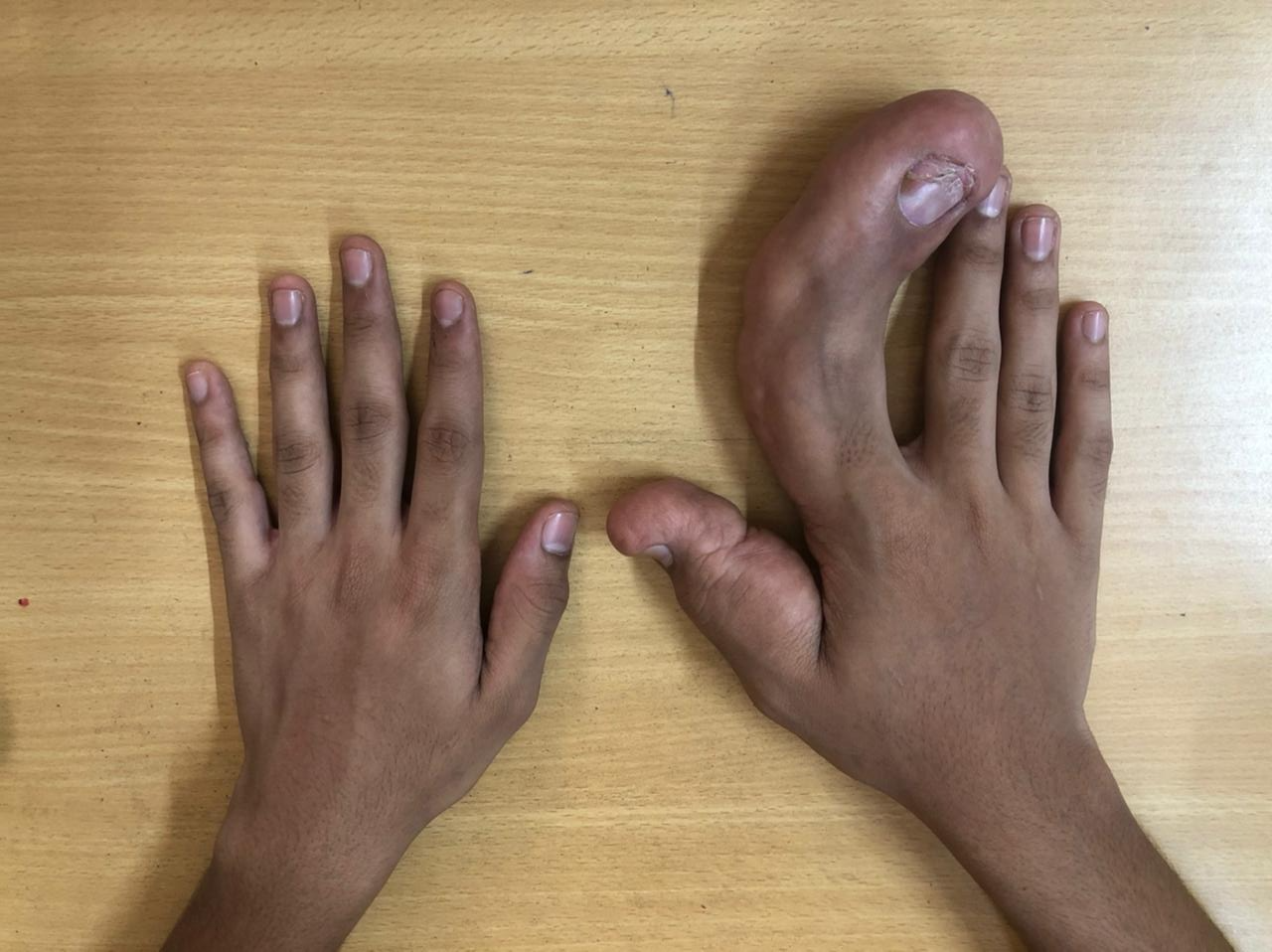 Congenital Anomalies Reconstruction